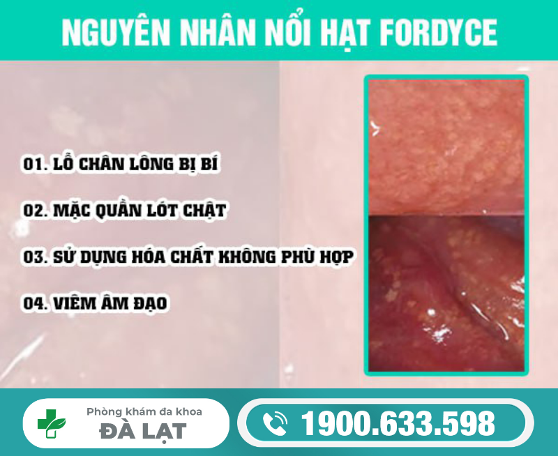 Hình ảnh minh họa